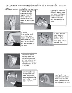 De-Quervain exer cise-page-001
